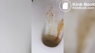 diarrhea again! a little shart..