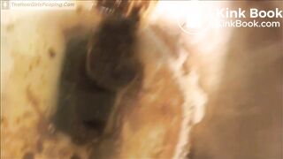 Messy diarrhea in dirty toilet