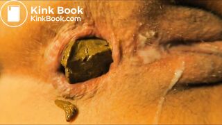 Close-up Shitting Assholes