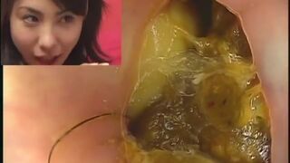 Asian Girl Poopy Anal Cam