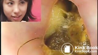 Asian Girl Poopy Anal Cam