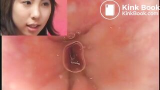 Asian Girl Poopy Anal Cam
