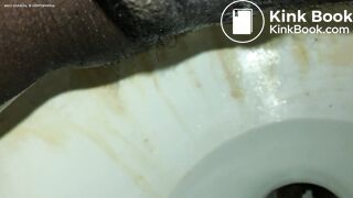 Turd knocking @ my back door