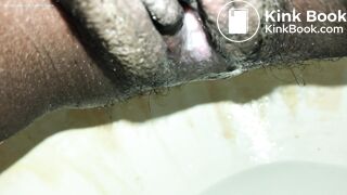 Turd knocking @ my back door