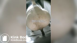 The girl used her hands to remove feces from her anus.