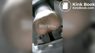 The girl used her hands to remove feces from her anus.