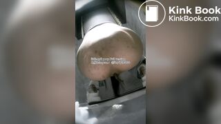 The girl used her hands to remove feces from her anus.