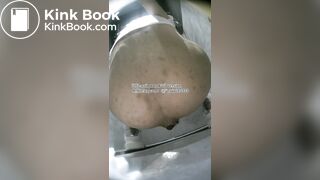 The girl used her hands to remove feces from her anus.