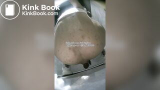 The girl used her hands to remove feces from her anus.