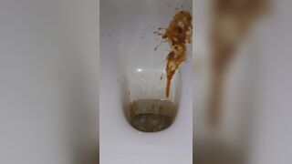 diarrhea with big spray