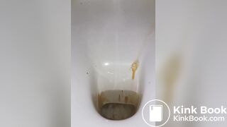 diarrhea with big spray