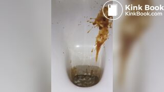 diarrhea with big spray