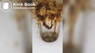 diarrhea with big spray