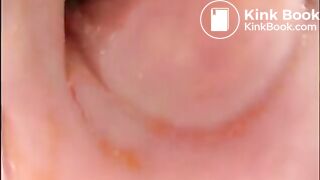 Camera in Arse with poo Asian. Buttcam