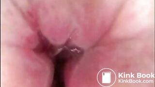 Camera in Arse with poo Asian. Buttcam