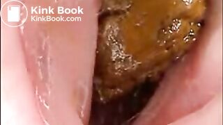 Camera in Arse with poo Asian. Buttcam