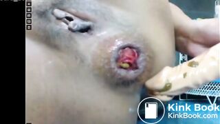 Chubby Asian Girl Dildo Shitty Asshole