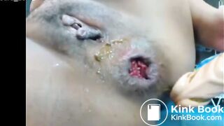 Chubby Asian Girl Dildo Shitty Asshole