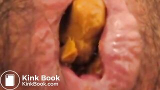 Anus When Defecating (Compilation)