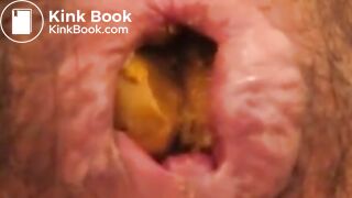 Anus When Defecating (Compilation)