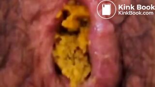 Anus When Defecating (Compilation)
