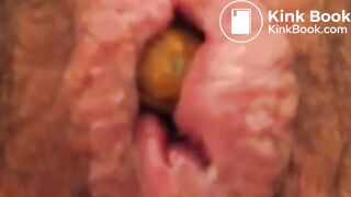 Anus When Defecating (Compilation)