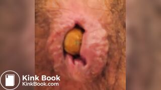 Anus When Defecating (Compilation)