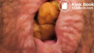 Anus When Defecating (Compilation)