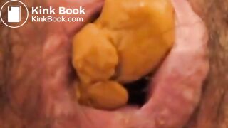 Anus When Defecating (Compilation)