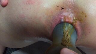 pushing out plug after 12 hours in ass