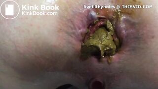 pushing out plug after 12 hours in ass