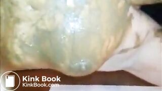 Wife gets partnerpoop stuffed inside birthcanal & orgasms out of disgust