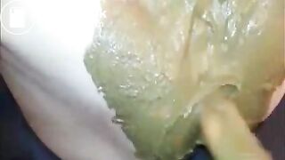 Wife gets partnerpoop stuffed inside birthcanal & orgasms out of disgust