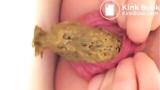 Prolapse and shit, my two favourites