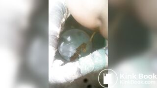 Diarrhea in the bucket