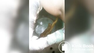 Diarrhea in the bucket