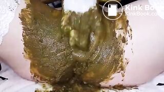 Speculum full of poop - part 3