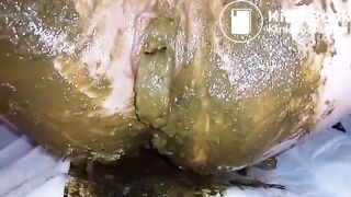 Speculum full of poop - part 3