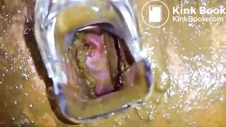 Speculum full of poop - part 3