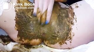 Speculum full of poop - part 3