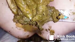 Speculum full of poop - part 3