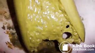 Speculum full of poop - part 3