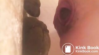 prolapsed ass shitting