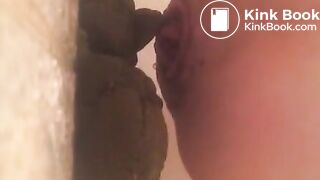 prolapsed ass shitting