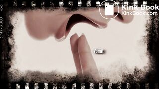 Vomit with dried shit