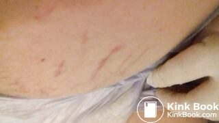 Diaper Enema aftermath