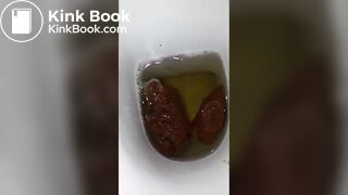 Night Close Hole Shit