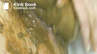 Hot m*aria diarrhea farting