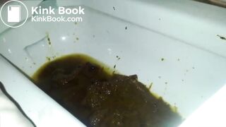 Asian Girl Diarrhea on the Toilet