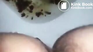 runny shit between legs 3